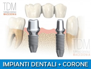 Impianti Turismo Dentale Macedonia